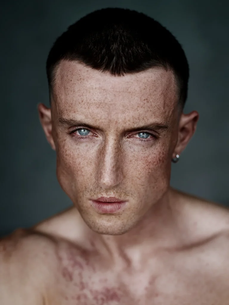 Nahaufnahme einer Person mit Sommersprossen und blauen Augen